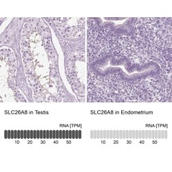 SLC26A8 Antibody, Novus Biologicals 0.1mL; Unlabeled:Antibodies, Polyclonal